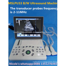 MSLPU33-i fréquence de 2 à 11 MHz Fonctionnement de l&#39;image B / W machine d&#39;échographie portable / scanner à ultrasons portable